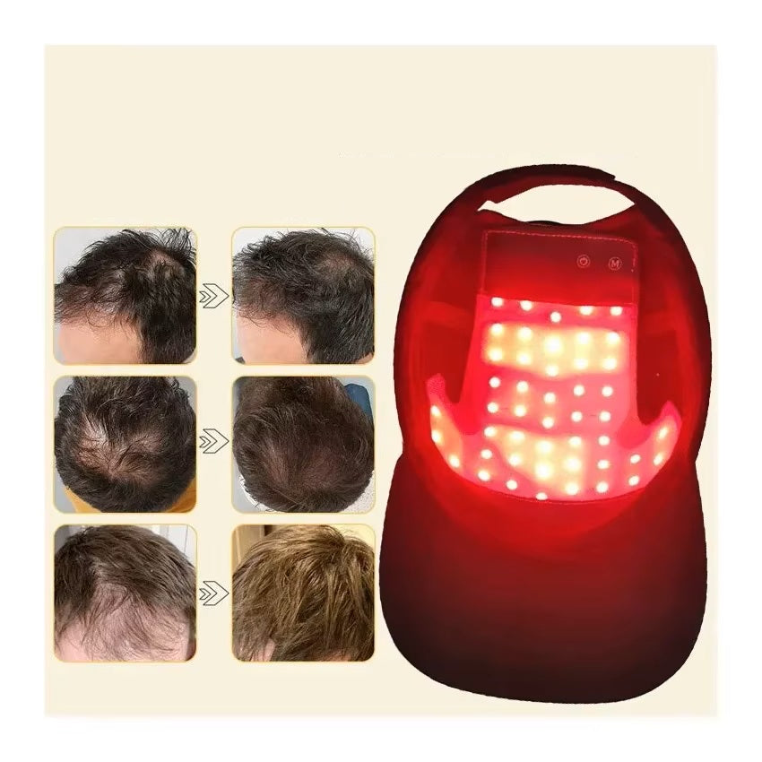 Gorra Terapia de Luz Roja para Creciemiento Capilar